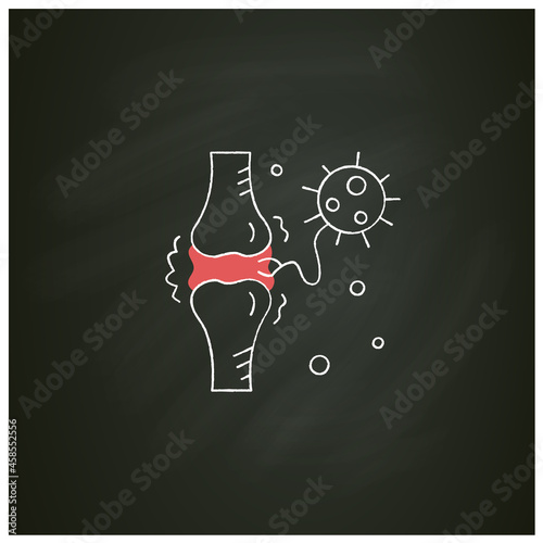 Joint pain chalk icon.Covid molecule attacking joints.Concept of corona virus disease system health effects, arthritis and high fever symptoms.Isolated vector illustration on chalkboard