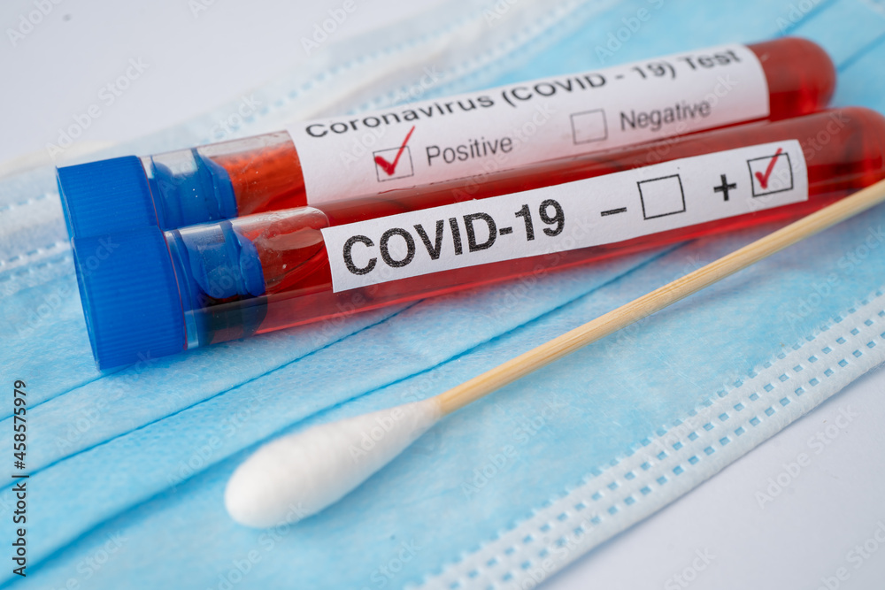 COVID-19 virus or Coronavirus sample blood test tube in laboratory of hospital.