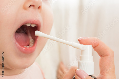 treatment of a child's oral cavity with a spray