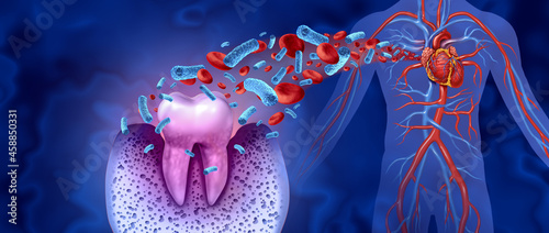 Tooth Decay Disease photo