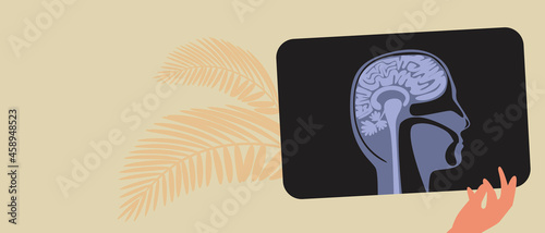 Brain x-ray, copy space template, flat vector illustration with x-ray or mri examination, skull and brain for design