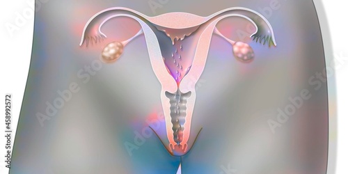 Tableau sur toile Anatomy of the female reproductive system during menstruation.