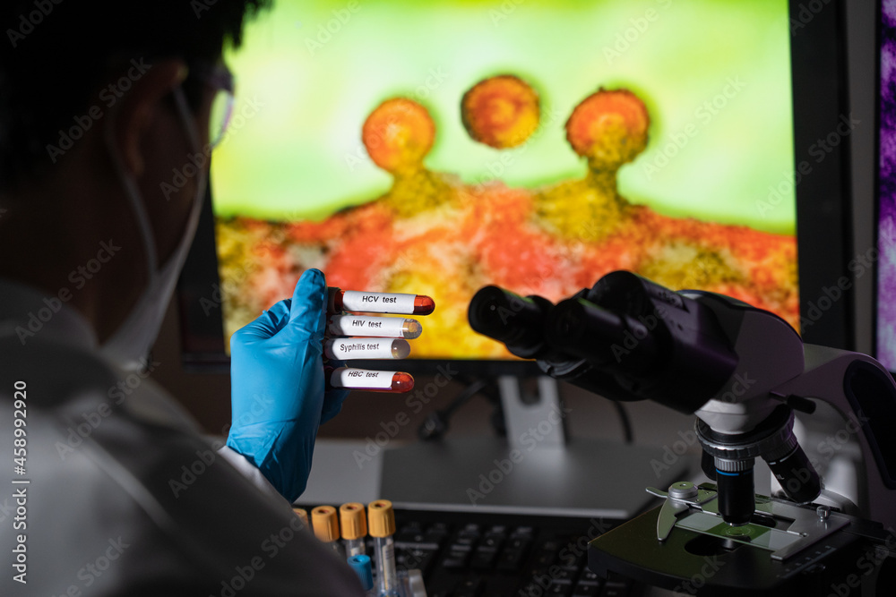 Blood tests to detect sexually transmitted diseases or STDs hepatitis