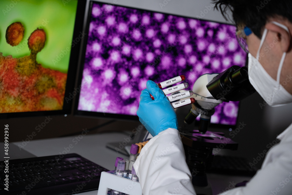 Blood tests to detect sexually transmitted diseases or STDs hepatitis