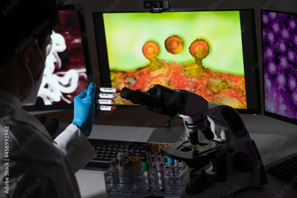 Blood tests to detect sexually transmitted diseases or STDs hepatitis