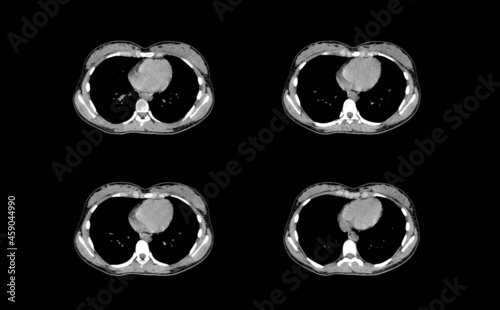 Abdomen ct scan and MRI professional images photo