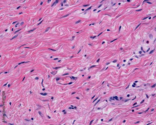 Skin. Dermis reticular