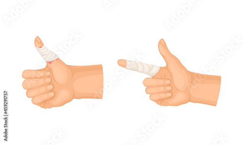 Wounded fingers with bandage. First aid for burn or cut wound vector illustration