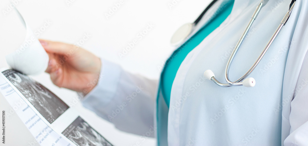 Woman doctor in white medical coat with stethoscope holds results of ultrasound scan in her hands. Nurse in hospital. Health care concept Woman doctor in white medical coat with stethoscope holds results of ultrasound scan in her hands. Nurse in hospital. Health care concept