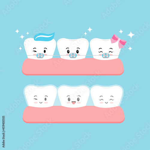 Invisible braces and brackets on tooth set. Dental invisalign braces vs metal white tooth orthodontic correction treatment concept. Vector flat design kawaii kid tooth dentistry mascot illustration.