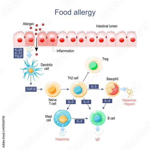 Food allergy. Inflammation of Intestine.
