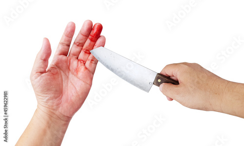 The knife cuts the hand, the wound is bleeding. unexpected accident different from the white background