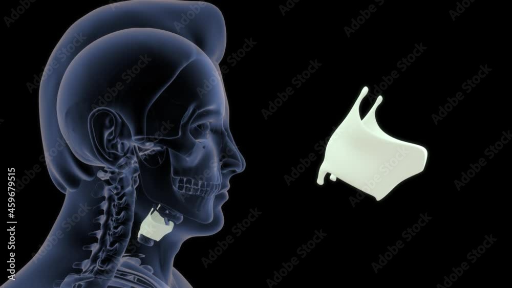 Thyroid cartilage Thyroid cartilage