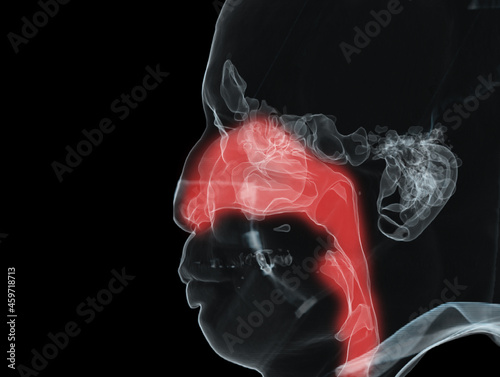 Anatomy of paranasal sinuses and  trachea airway 3D illustration . photo