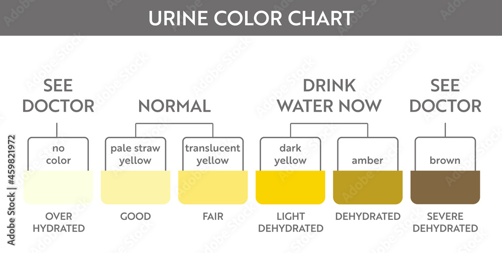 Urine color chart. Pee hydration and dehydration test strip. Vector ...
