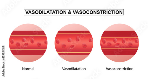 Vasodilation and vasoconstriction. comparison of Blood vessels. photo