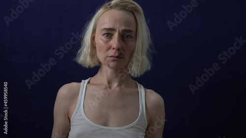 Bruises on the woman's face. A woman holds a placard with the text NO IS NO.