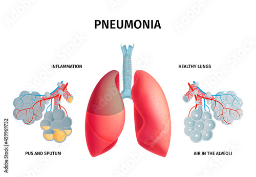 Human Lung Anatomy Infochart