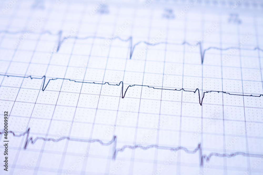 Heart waves recorded on paper called an electrocardiogram. Study of the heart.