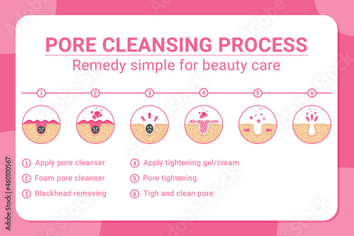 Vector banner 6 tips for blackheads removing and pore cleansing process. Acne or blackhead pore cleansing process with remedy simple for beauty care in isolated white background. Design for skincare