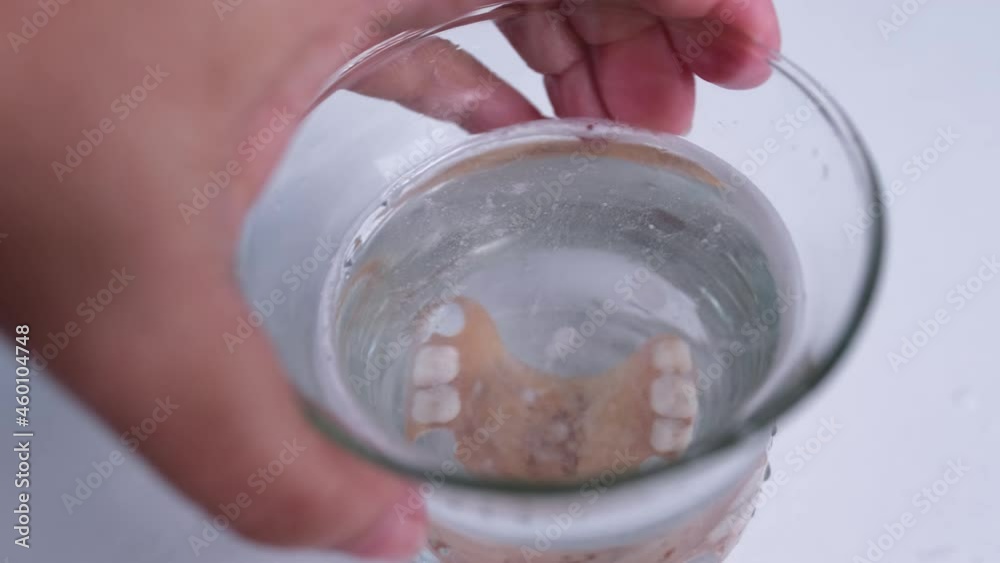 female hand close-up puts partial plastic prosthesis for the upper jaw of a person in glass, disinfecting soluble effervescent tablet lies in water, air bubbles rise female hand close-up puts partial plastic prosthesis for the upper jaw of a person in glass, disinfecting soluble effervescent tablet lies in water, air bubbles rise