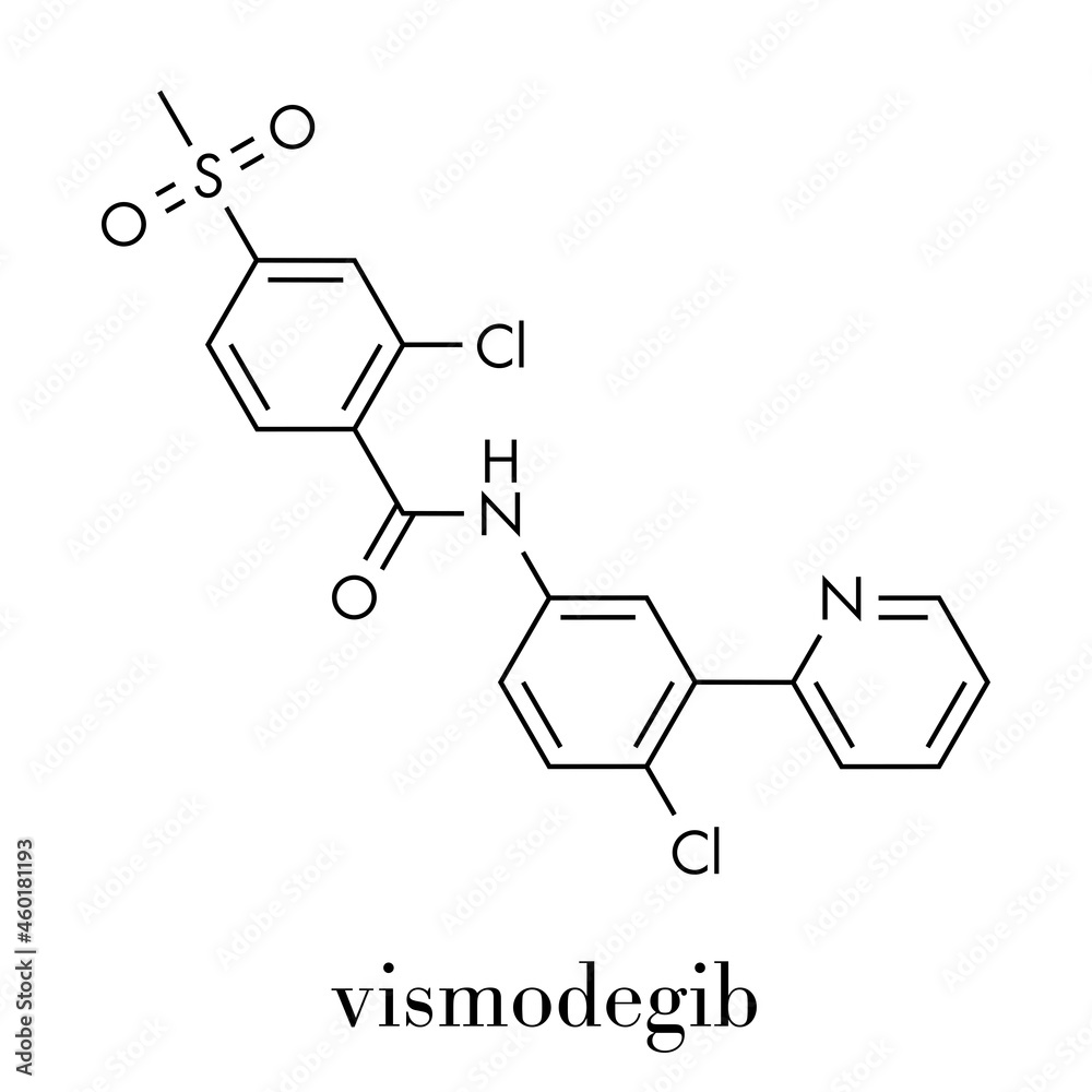 Vismodegib cancer drug molecule. Used in treatment of basal cell carcinoma. Skeletal formula.