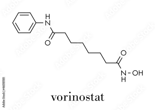 Vorinostat cutaneous T cell lymphoma drug molecule. Acts as histone deacetylase inhibitor. Skeletal formula. photo