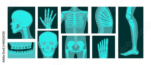X-ray of human body parts vector illustrations set. Bones of skeleton, roentgen of head, chest, hand, leg, knee, foot radiographs isolated on white background. Anatomy, medicine, health concept