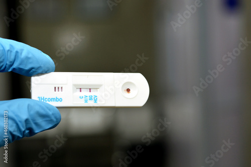 Positive result of Hepatitis B surface antigen and negative HCV and HIV AIDS in a rapid test cassette kit for Hepatitis C virus antibodies HCV AB, Human Immune virus HIV AIDS test and HBsAG HBV photo