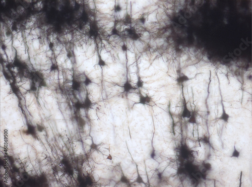 Mouse brain section stained with the Golgi stain, a 19th century technique that was  widely used until recently -  and occasionally still is. Widefield microscopy. Neurons in the cerebral cortex. photo