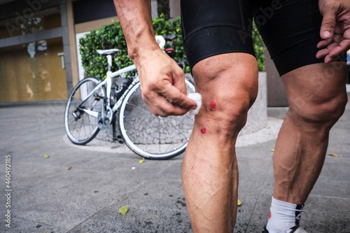 Close-up of cyclist cleaning his bruises on leg after falling from bike.