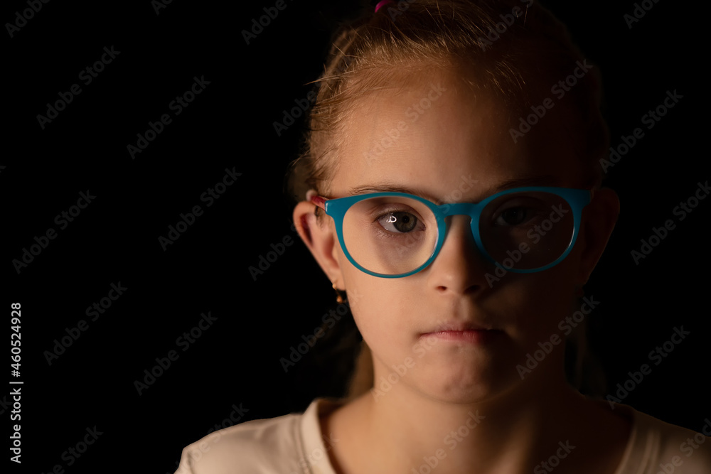 portrait of a girl with Down syndrome portrait of a girl with Down syndrome