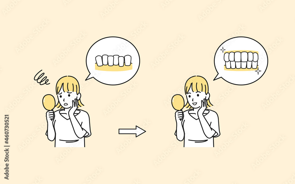 歯並びを気にする若い女性 歯の悩み コンプレックス 治療 歯列矯正 矯正後 イラスト素材 Stock Vector Adobe Stock