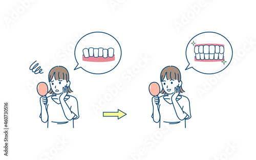 歯並びを気にする若い女性　歯の悩み　コンプレックス　治療　歯列矯正　矯正後　イラスト素材
