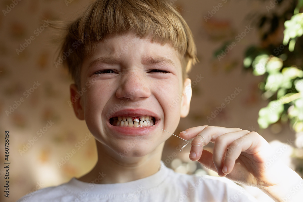 Ginger boy is pulling tooth with help of thread. His face is full of