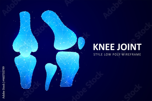 Abstract polygonal knee-joint