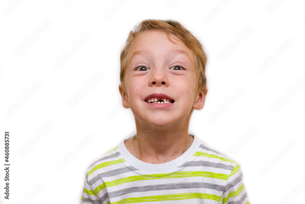 The boy smiles without a tooth. Child has lost upper tooth, close-up isolate on white background The boy smiles without a tooth. Child has lost upper tooth, close-up isolate on white background