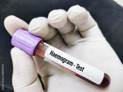 Blood sample tube for Haemogram or Complete Blood Cell (CBC) test