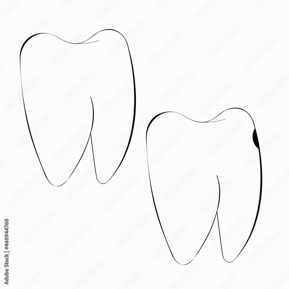 An outline vector illustration of two teeth: the healthy one and