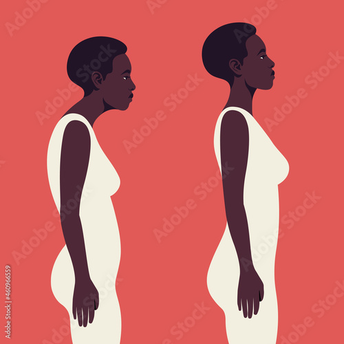 An African woman with a bad posture. Spine. Profile. Kyphosis. Flat vector illustration on red background. Minimalism