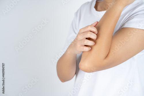 Asian beauty woman has dry skin and scratching her arm and elbow.
