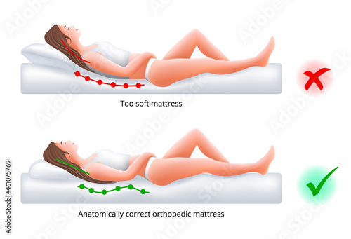 Choosing an orthopedic mattress for sleeping - Correct and incorrect sleeping position on back, vector illustration.