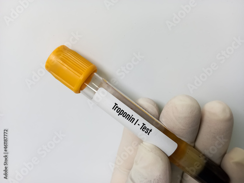 Blood sample for Troponin-I test, diagnosis for cardiovascular disease. myocardial infarction