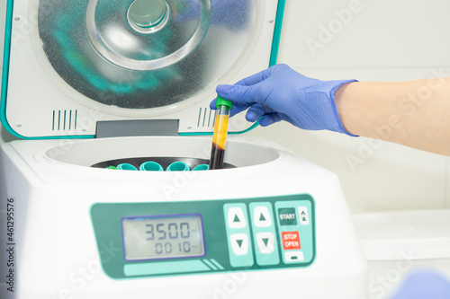 A hand in a blue medical glove pulls out a test tube with blood plasma from the centrifuge. soncept of laboratory blood tests and cosmetological injections of beauty of skin and hair.