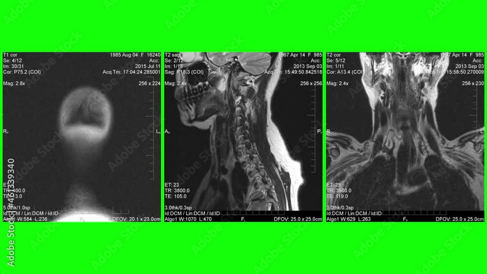 MRI , Magnetic resonance images of human body parts, green background ... Biology Diagrams