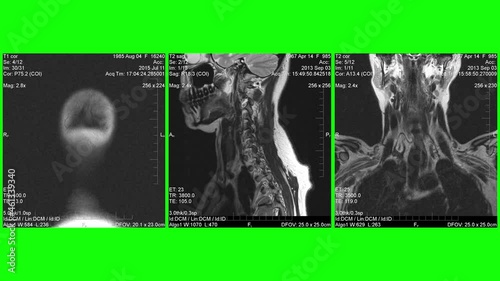 MRI , Magnetic resonance images of human body parts, green background for transparency. photo