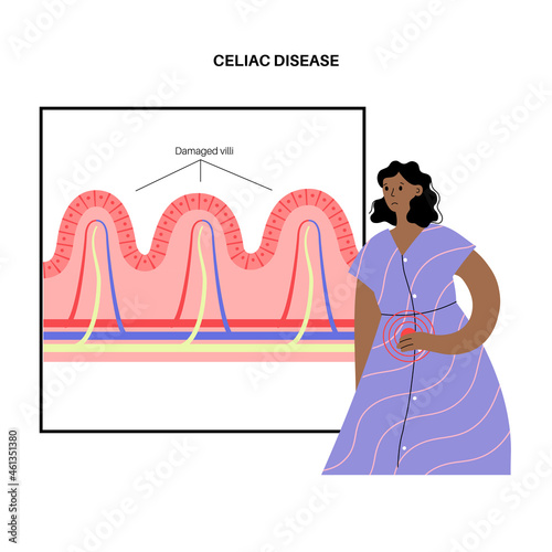 Celiac disease inflammation