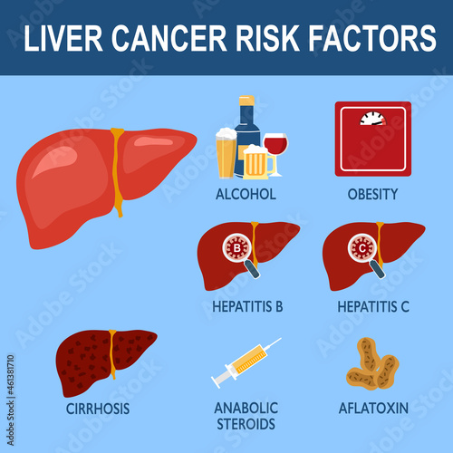 Liver cancer risk factors infographic vector illustration.