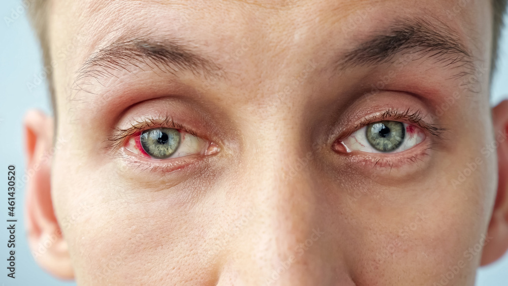 Fototapeta premium young man with red eyes looking at the camera.