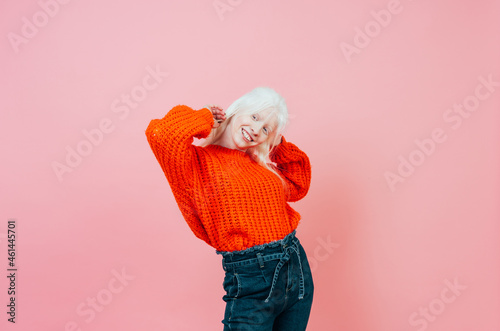 Lidestyle image of an albino girl posing in studio. Concept about body positivity, diversity, and fashion